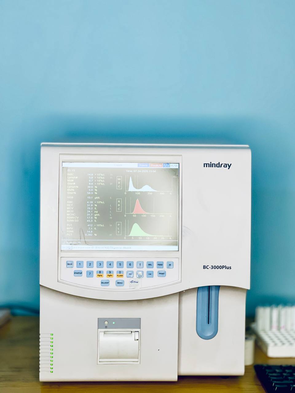 Automated Lab Analyzer